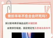江南体育全站-包含穆西亚拉腓骨骨折+韧带受伤预计伤缺4-5个月的词条
